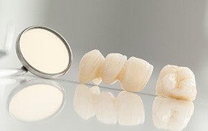 Custom dental crown and bridge