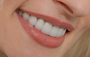 Closeup of healthy smile thanks to dental sealants