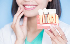 Dentist holding model implant with one hand and touching cheek with the other