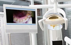 Intraoral photos on computer screen