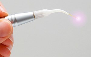 Soft tissue laser wand
