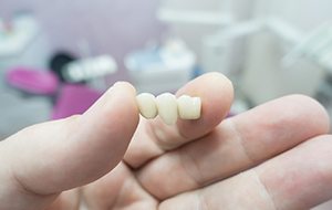 A dentist’s hands holding a three tooth dental bridge.