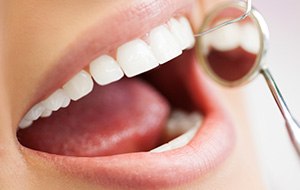 Closeup of patient during dental exam