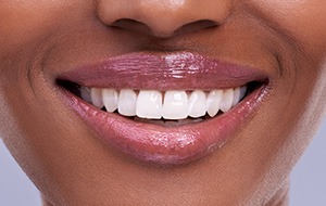 Closeup of flawless smile after dental bonding