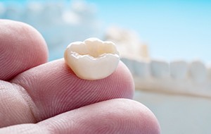 Dental crowns protect damaged and decayed teeth