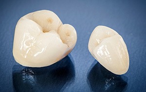Two dental crowns on tabletop