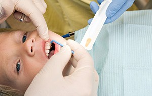 Child receiving dental sealants