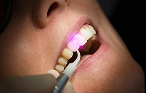 Patient receiving laser gum contouring treatment