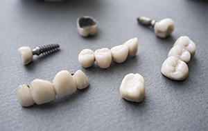 Implant crowns and bridges