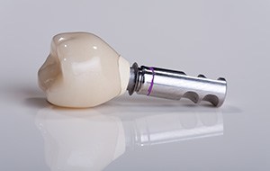 Implant supported dental crown
