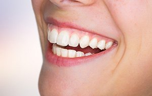 Closeup of patient with healthy teeth and gums