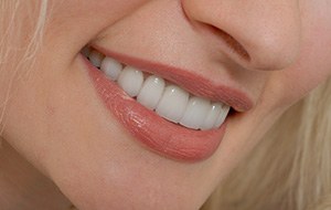Closeup of healthy smile thanks to protective dental sealants