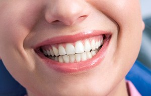 Closeup of healthy beautiful smile thanks to fluoride treatment