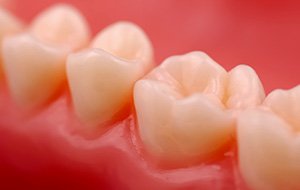 Closeup of tooth with natural looking tooth-colored fillings