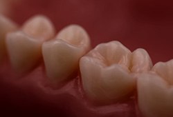 Closeup of flawlessly repaired teeth after restorative dentistry