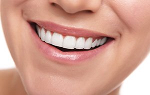 Closeup of beautiful smile after tooth contouring