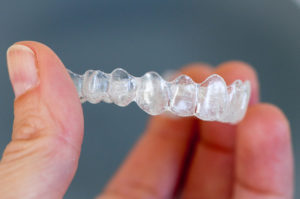 What are the most important questions you should ask your dentist about Invisalign in Lincoln? Find out here. 